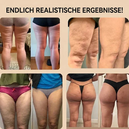 3D Anti-Cellulite Leggings
